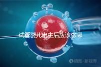 試管嬰兒出生后應該做哪些檢查答案？DR應該看情況嗎？
