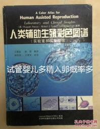 試管嬰兒多精入卵概率多少難說，比正常配對低別瞎操心