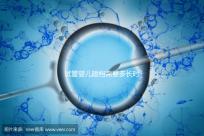 試管嬰兒建檔需要多長時間進(jìn)來瞧，內(nèi)含詳細(xì)流程供參考