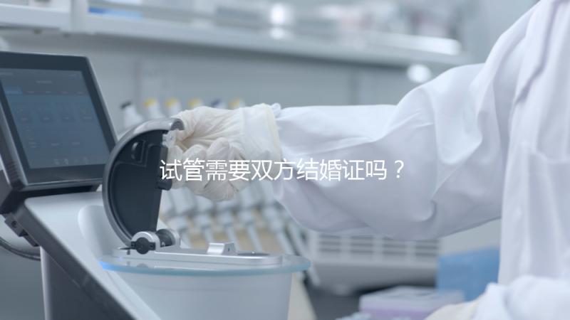 試管需要雙方結婚證嗎?試管是不是需要結婚證