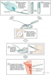 貴陽未婚子女戶口如何向婦女介紹，附2024年結算流程