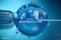 誰(shuí)說(shuō)做試管的丈夫只戒煙十天沒有影響，前一天晚上抽煙或者很難移植？