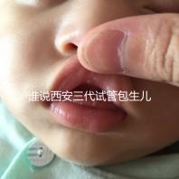 誰(shuí)說(shuō)西安三代試管包生兒子多少錢看醫(yī)院，能不能做還兩說(shuō)