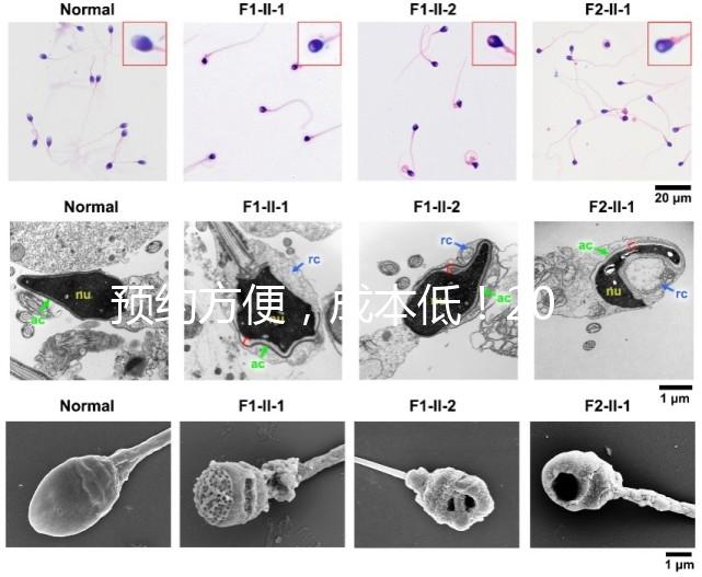 預(yù)約方便，成本低！2024年西安新城、臨潼、雁塔四維彩超指南