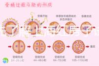 預(yù)先了解上海紅房子試管建檔流程,最快當(dāng)天可定方案