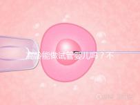 高齡能做試管嬰兒嗎?不是想做就能做得滿足這5個條件