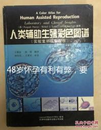 48歲懷孕有利有弊，要不要生需考慮這3點！