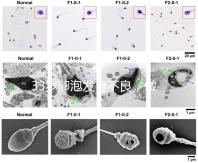 33歲卵泡發(fā)育不良，做試管黃體期促排方案失敗怎么辦？