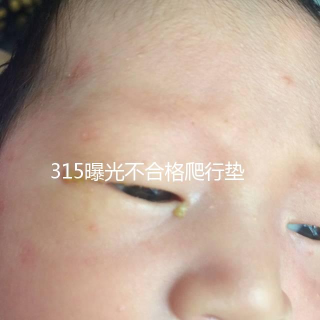 315曝光不合格爬行墊品牌，甲酰胺超標的危害可不小