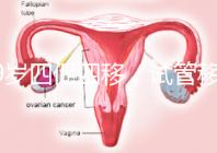 39歲四促四移，試管移植失敗5次后應該怎么辦？