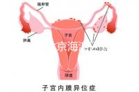2024年北京海淀區(qū)新生兒醫(yī)療保險處理策略，照片要求不要出錯