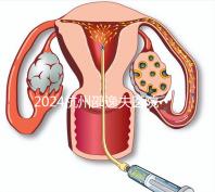 2024杭州邵逸夫醫(yī)院專(zhuān)家門(mén)診表，醫(yī)生上班時(shí)間一網(wǎng)打盡！