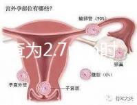 nt檢查為2.7mm時危險性莫亂猜，做完無創后才能確定